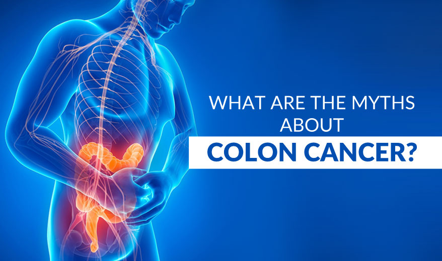 myths about colon cancer